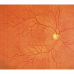 M82 Eye Examination Simulator II (3 step) - Image 4