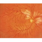 M82 Eye Examination Simulator II (3 step) - Image 3