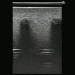 M43E Ultrasound Lumbar Puncture Epidural Simulator - Image 2