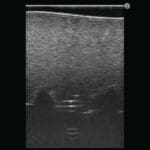 M43E Ultrasound Lumbar Puncture Epidural Simulator - Image 3