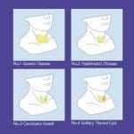 MW62 Thyroid Palpation Simulator - Image 4