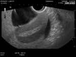 Female Pelvic Ultrasound Phantom US-10C - Image 9