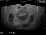 Female Pelvic Ultrasound Phantom US-10C - Image 8