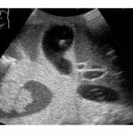 Ultrasound Examination Training Phantom ABDFAN US-1B - Image 4