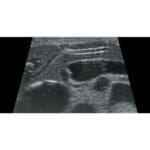 Abdominal Intraoperative Laparoscopic Ultrasound Phantom IOUSFAN US-3 - Image 2
