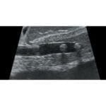 Abdominal Intraoperative Laparoscopic Ultrasound Phantom IOUSFAN US-3 - Image 5