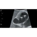 Abdominal Intraoperative Laparoscopic Ultrasound Phantom IOUSFAN US-3 - Image 4