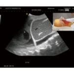FAST Acute Abdomen Phantom FAST ER FAN US-5 - Image 2