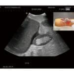 FAST Acute Abdomen Phantom FAST ER FAN US-5 - Image 3