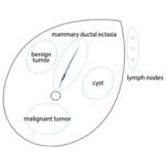 Breast Ultrasound Examination Phantom BREAST FAN US-6 - Image 4