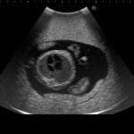 Fetus Ultrasound Examination Phantom SPACE FAN ST US-7A - Image 2