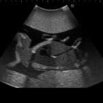 Fetus Ultrasound Examination Phantom SPACE FAN ST US-7A - Image 4