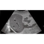 Pediatric FAST Acute Abdomen Phantom US-8 - Image 3