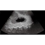 Pediatric FAST Acute Abdomen Phantom US-8 - Image 2