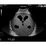 Ultrasound Neonatal Head Phantom US-14A - Image 2