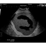 Ultrasound Neonatal Head Phantom US-14A - Image 5