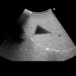 Fundamental Ultrasound Phantom US18 - Image 3