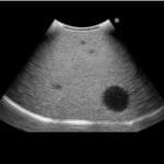 Fundamental Ultrasound Phantom US18 - Image 4