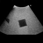 Fundamental Ultrasound Phantom US18 - Image 5