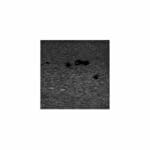 US-21 DVT (Deep Vein Thrombosis) Phantom - Image 2