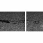 US-21 DVT (Deep Vein Thrombosis) Phantom - Image 4