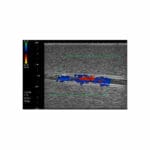 US-21 DVT (Deep Vein Thrombosis) Phantom - Image 3