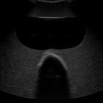 Rectal and Bladder Ultrasound Phantom US23 - Image 4