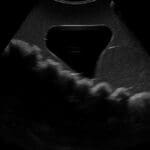 Rectal and Bladder Ultrasound Phantom US23 - Image 3