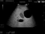 Female Pelvic Ultrasound Phantom US-10C - Image 10