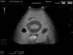 Female Pelvic Ultrasound Phantom US-10C - Image 6