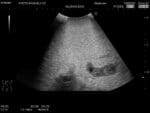 Female Pelvic Ultrasound Phantom US-10C - Image 7