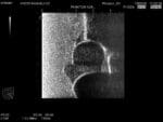 Infant Hip Sonography Training Phantom US-13 - Image 3