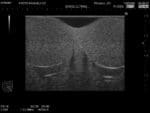 Normal Scrotum Ultrasound Phantom US-11 - Image 3