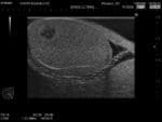 Normal Scrotum Ultrasound Phantom US-11 - Image 2