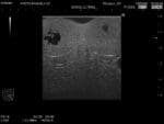 Normal Scrotum Ultrasound Phantom US-11 - Image 4