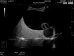 Intravesical Urine Volume Measurement Phantom US-16 - Image 6