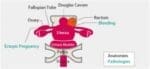 Female Pelvic Ultrasound Phantom US-10C - Image 11