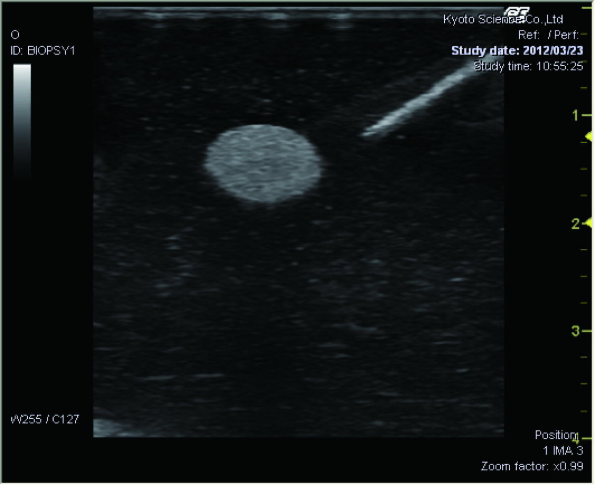 Ultrasound Guided Breast Biopsy Training Model - Duo (Transparent and Opaque) set US-9 - Image 2