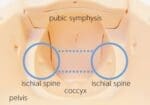 MW40 Obstetric Training Simulator Complete Set - Image 2