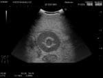 Female Pelvic Ultrasound Phantom US-10C - Image 17