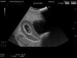 Female Pelvic Ultrasound Phantom US-10C - Image 18