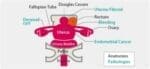 Female Pelvic Ultrasound Phantom US-10C - Image 5