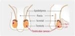Normal Scrotum Ultrasound Phantom US-11 - Image 5