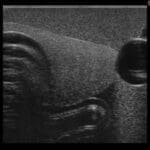 Ultrasound Guided Tube Feeding Phantom US20 - Image 2